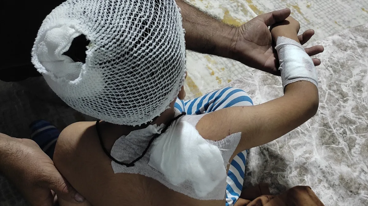 Şanlıurfa’da sahipsiz köpekler 8 yaşındaki çocuğu yaraladı
