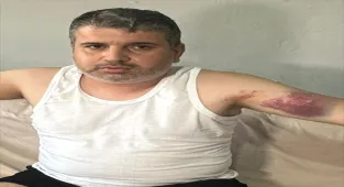 Adana'da yeğenini beyzbol sopasıyla darbeden kişi tutuklandı