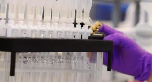 Alman Bayer'den ABD'deki kanser davaları için 7,25 milyar dolarlık uzlaşma planı