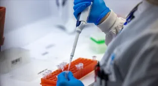 Gana'da M çiçeği vaka sayısı 993'e yükseldi